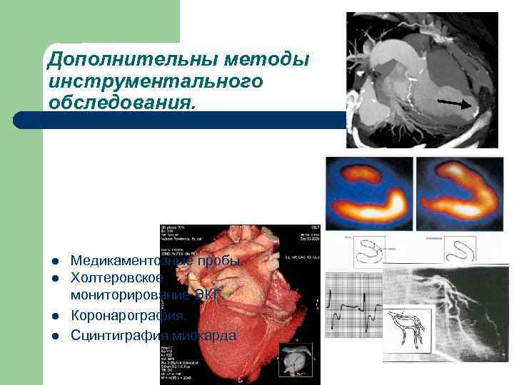 Дополнительны методы инструментального обследования. l l Медикаментозные пробы. Холтеровское мониторирование ЭКГ. Коронарография. Сцинтиграфия миокарда