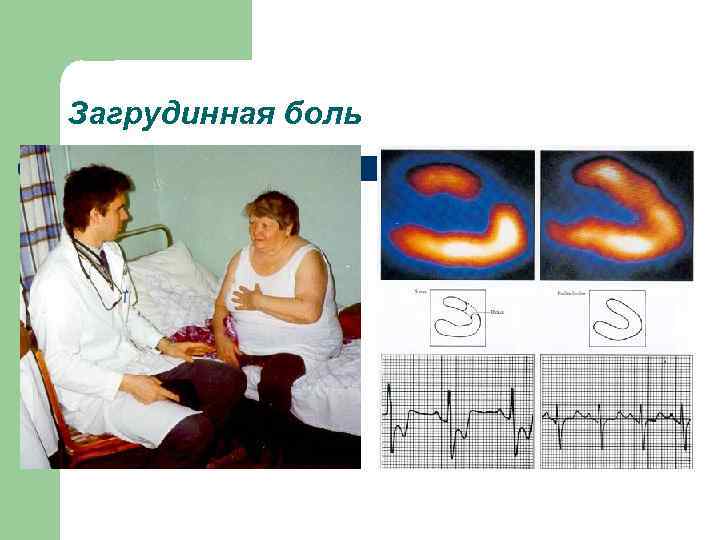 Загрудинная боль 