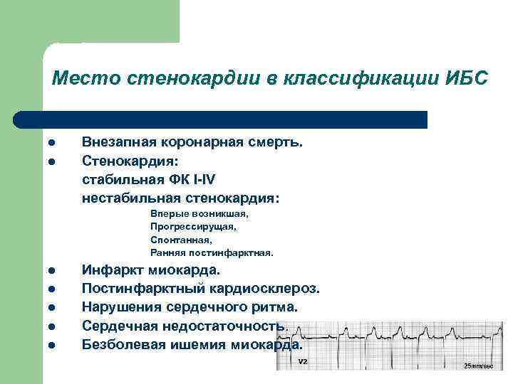 Место стенокардии в классификации ИБС l l Внезапная коронарная смерть. Стенокардия: стабильная ФК I-IV