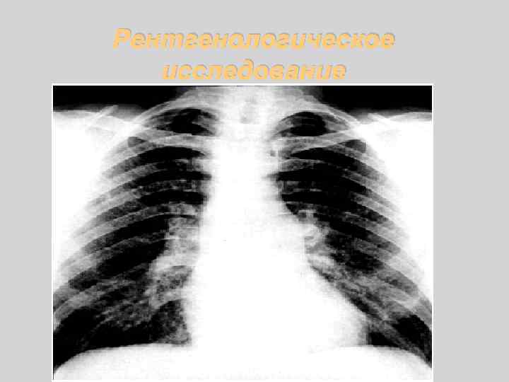 Рентгенологическое исследование 