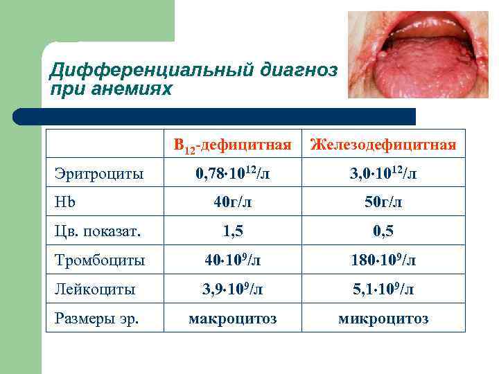 Дифференциальный диагноз при анемиях В 12 -дефицитная Железодефицитная 0, 78 1012/л 3, 0 1012/л