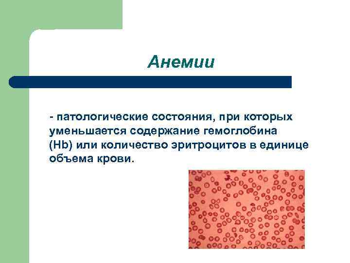 Анемии - патологические состояния, при которых уменьшается содержание гемоглобина (Hb) или количество эритроцитов в