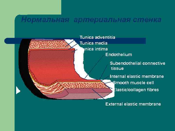 Нормальная артериальная стенка Tunica adventitia Tunica media Tunica intima Endothelium Subendothelial connective tissue Internal