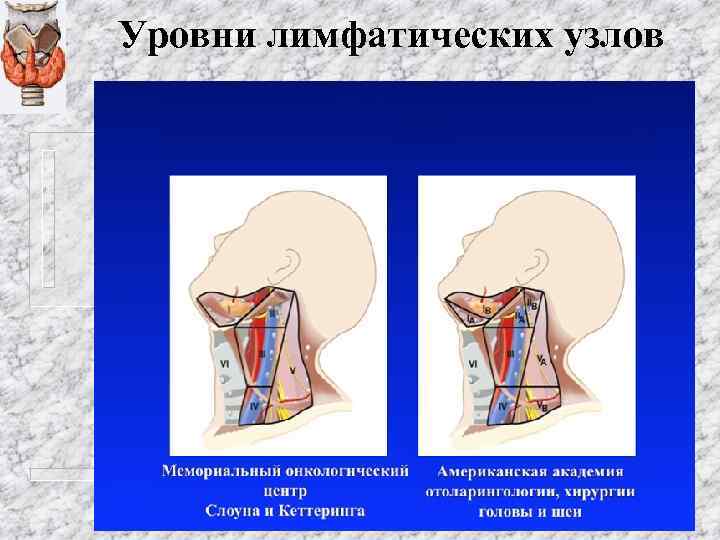 Уровни лимфатических узлов 