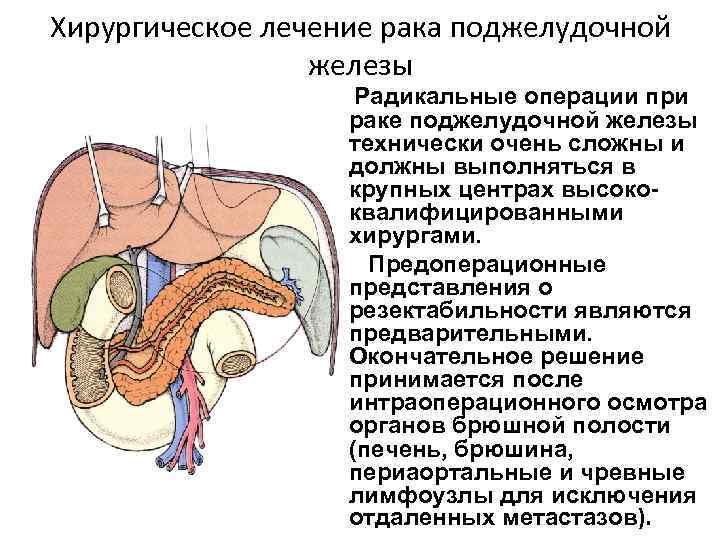 Стол при раке поджелудочной железы