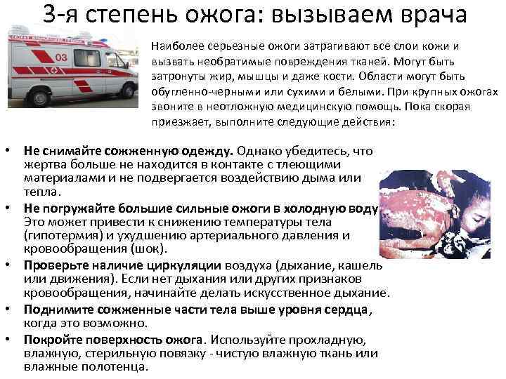 3 -я степень ожога: вызываем врача Наиболее серьезные ожоги затрагивают все слои кожи и