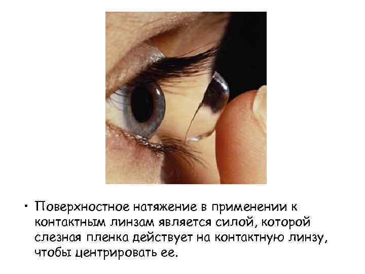  • Поверхностное натяжение в применении к контактным линзам является силой, которой слезная пленка