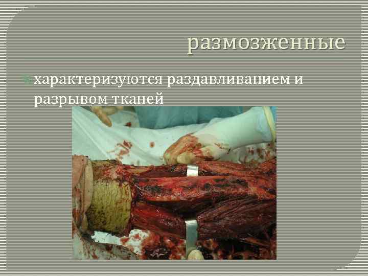 размозженные характеризуются разрывом тканей раздавливанием и 