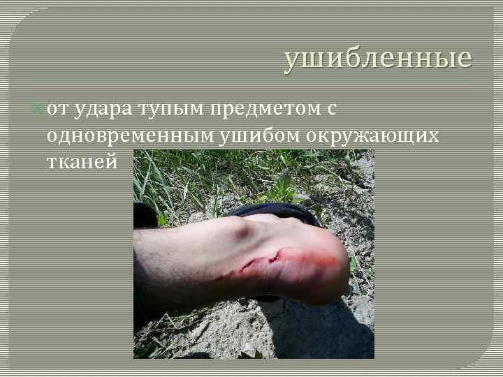 ушибленные от удара тупым предметом с одновременным ушибом окружающих тканей 