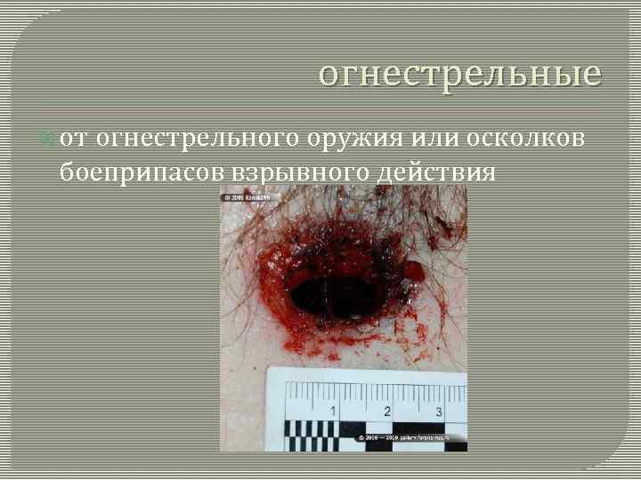огнестрельные от огнестрельного оружия или осколков боеприпасов взрывного действия 