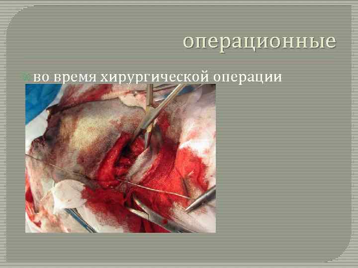 операционные во время хирургической операции 