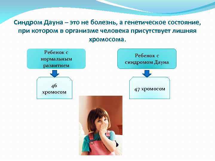 Синдром Дауна – это не болезнь, а генетическое состояние, при котором в организме человека