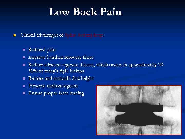 Low Back Pain n Clinical advantages of Spine Arthroplasty: n n n Reduced pain