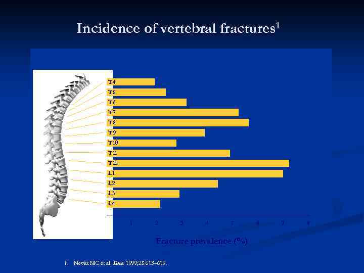 Incidence of vertebral fractures 1 T 4 T 5 T 6 T 7 T