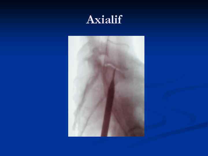 Axialif 