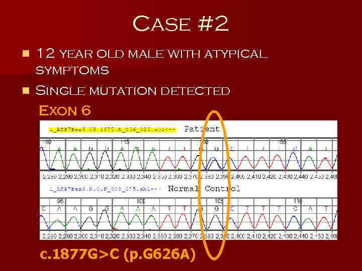 Case #2 12 year old male with atypical symptoms n Single mutation detected Exon