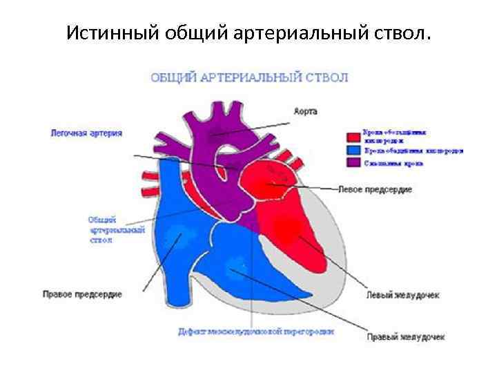 Общий артериальный ствол презентация