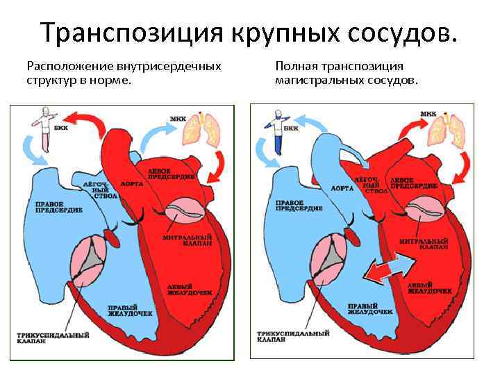 Лады ограниченной транспозиции мессиана