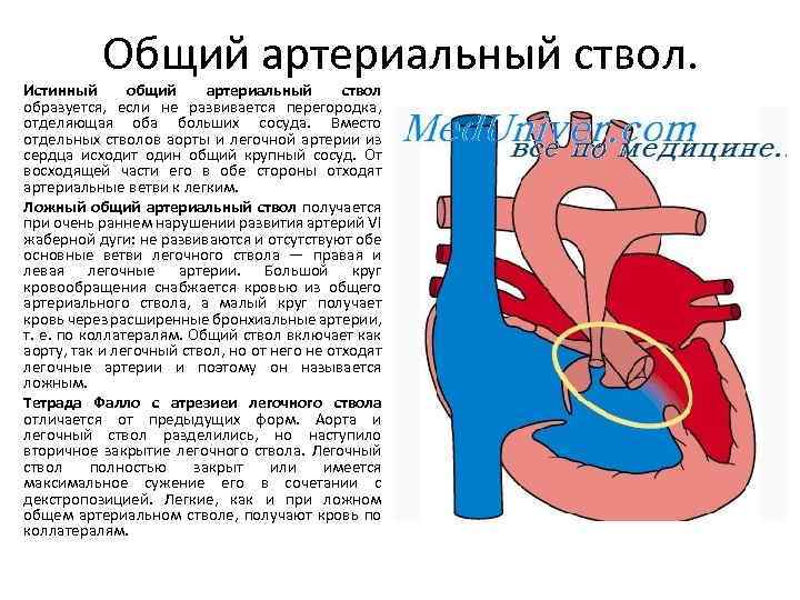 Общий артериальный ствол презентация