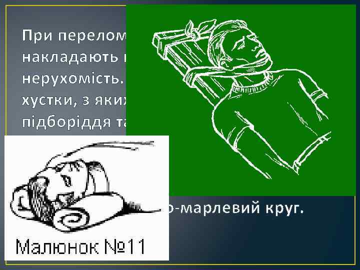 При переломі нижньої щелепи накладають пов'язку, що забезпечує її нерухомість. Для цього беруть дві