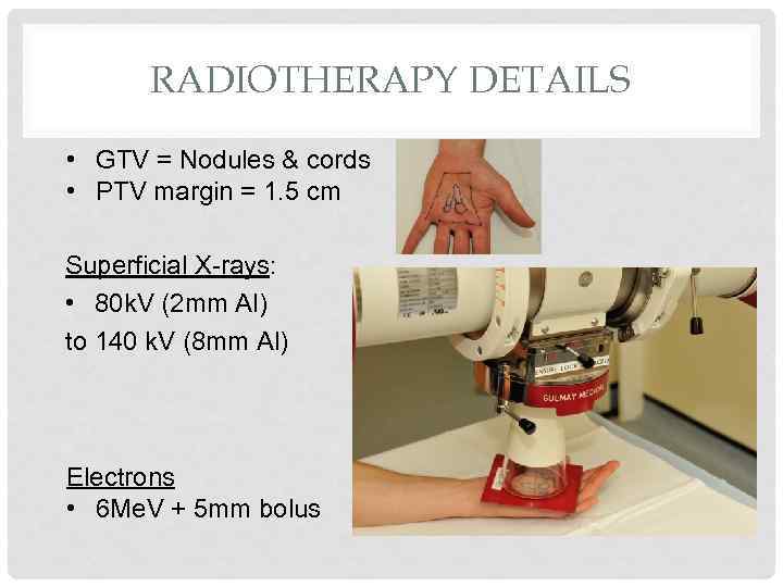 RADIOTHERAPY DETAILS • GTV = Nodules & cords • PTV margin = 1. 5