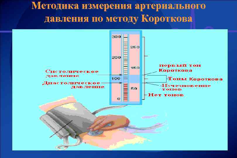 Методика измерения артериального давления по методу Короткова 