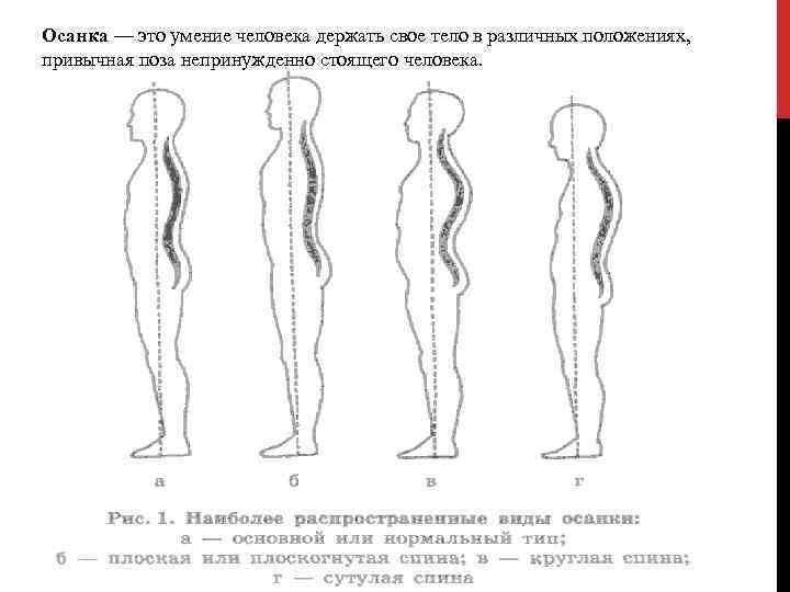 Привычное положение тела стоящего человека. Привычная поза непринужденно стоящего человека.