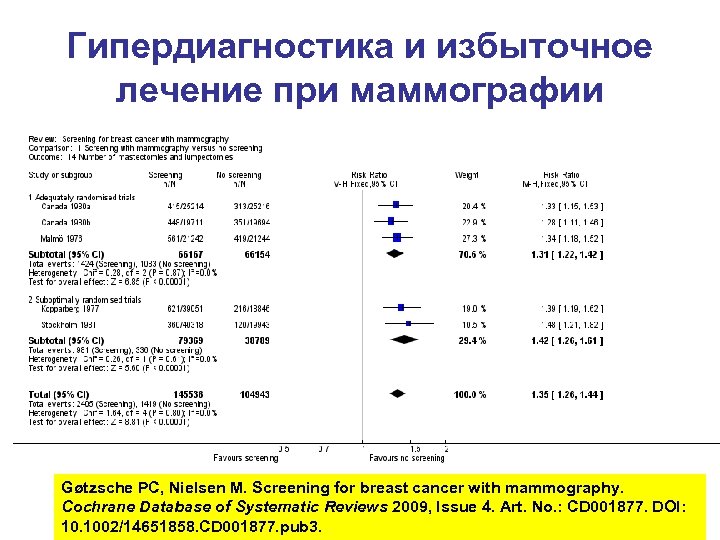 Гипердиагностика и избыточное лечение при маммографии Gøtzsche PC, Nielsen M. Screening for breast cancer