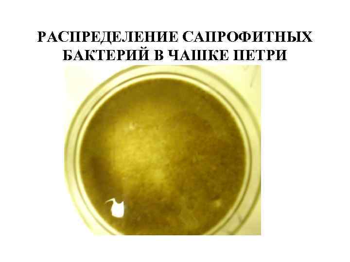 РАСПРЕДЕЛЕНИЕ САПРОФИТНЫХ БАКТЕРИЙ В ЧАШКЕ ПЕТРИ 