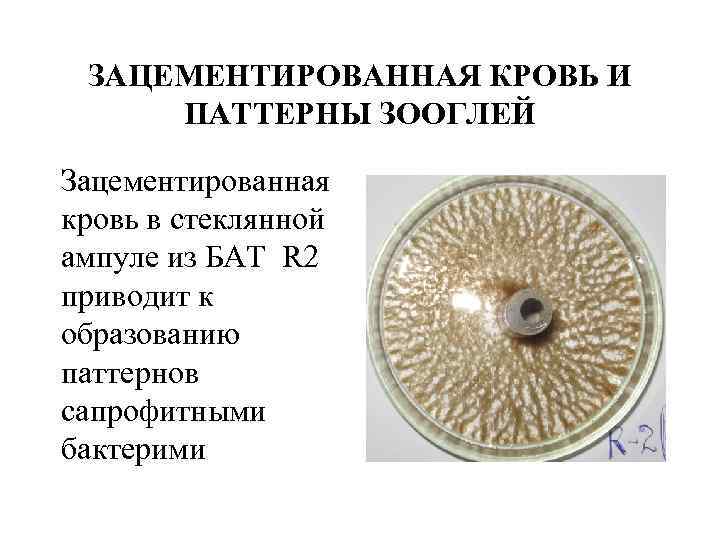 ЗАЦЕМЕНТИРОВАННАЯ КРОВЬ И ПАТТЕРНЫ ЗООГЛЕЙ Зацементированная кровь в стеклянной ампуле из БАТ R 2