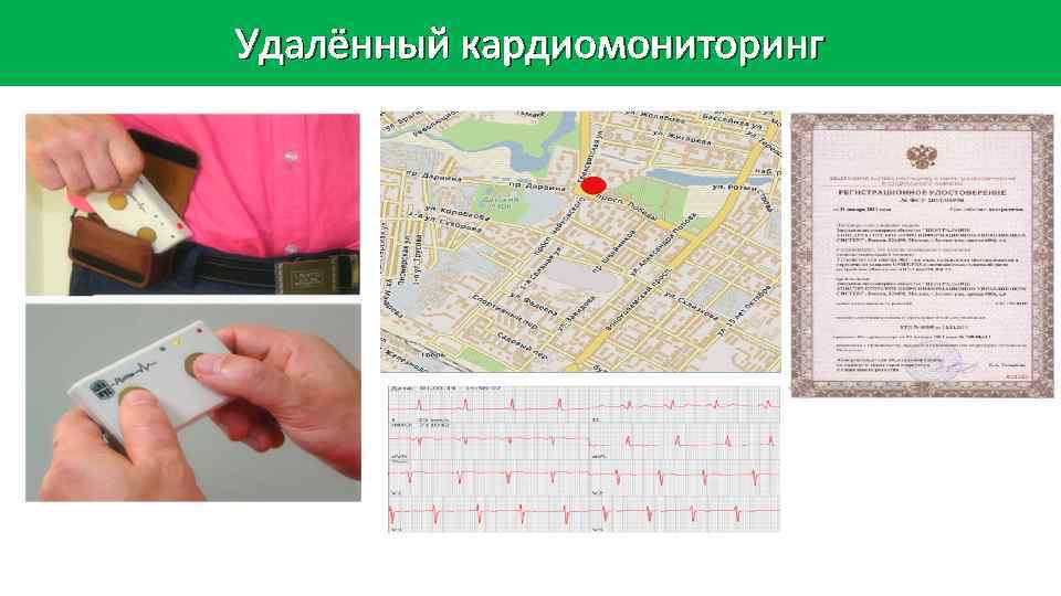 Удалённый кардиомониторинг 