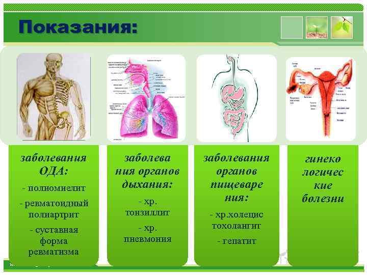 Показания: заболевания ОДА: - полиомиелит - ревматоидный полиартрит - суставная форма ревматизма www. themegallery.