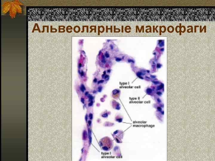 Альвеолярные макрофаги 