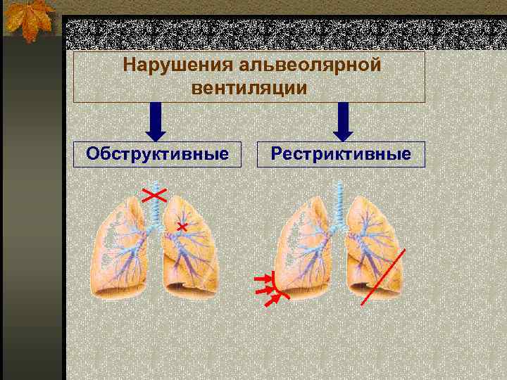 Нарушения альвеолярной вентиляции Обструктивные Рестриктивные 