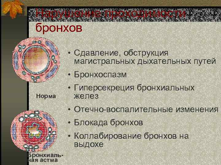 Нарушение проходимости бронхов • Сдавление, обструкция магистральных дыхательных путей • Бронхоспазм Норма • Гиперсекреция