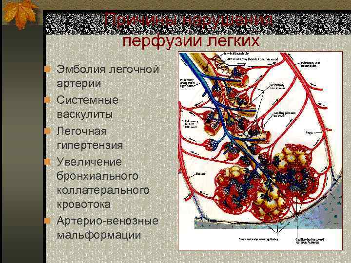 Причины нарушения перфузии легких n Эмболия легочной n n артерии Системные васкулиты Легочная гипертензия