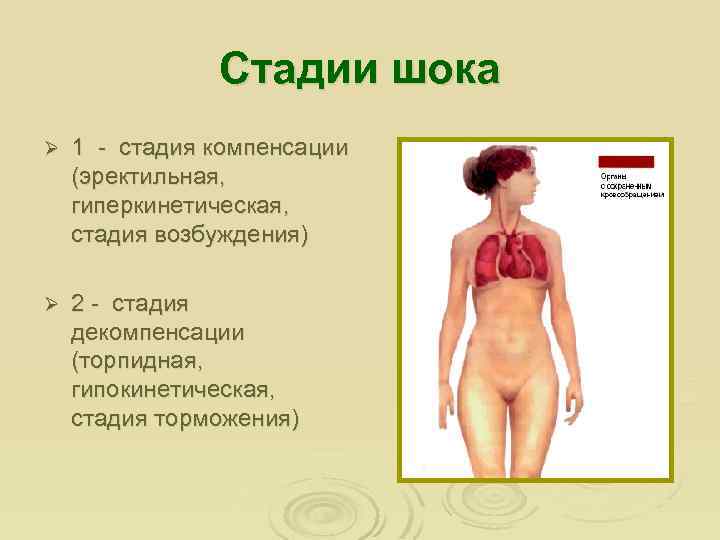 Стадии шока Ø 1 - стадия компенсации (эректильная, гиперкинетическая, стадия возбуждения) Ø 2 -