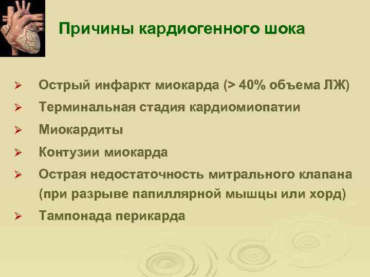 Причины кардиогенного шока Ø Острый инфаркт миокарда (> 40% объема ЛЖ) Ø Терминальная стадия