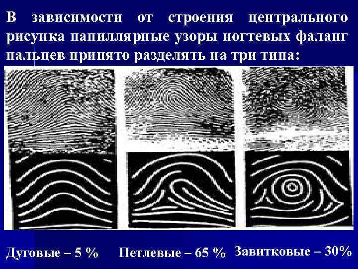 В зависимости от рисунка центральной части ногтевого фаланга пальца руки папиллярные узоры бывают