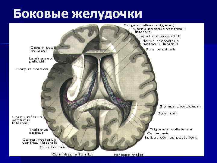 Боковые желудочки 