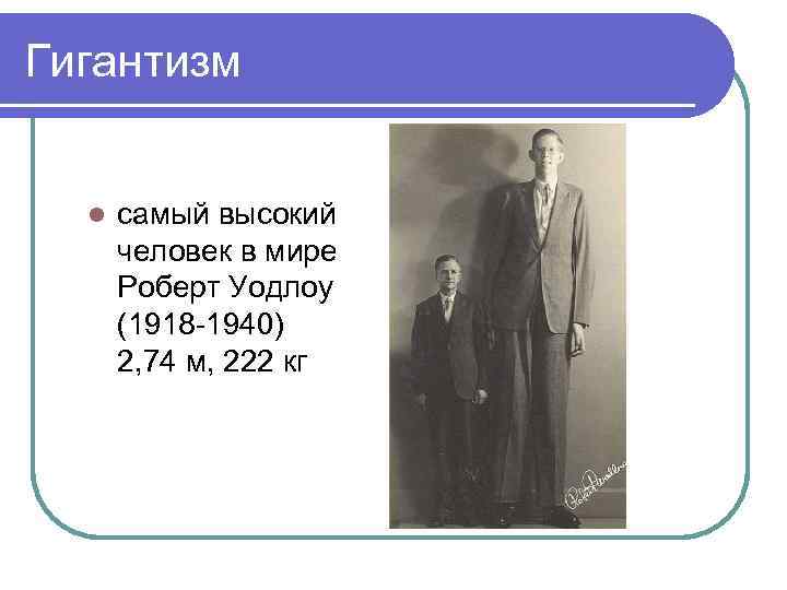 Гигантизм l самый высокий человек в мире Роберт Уодлоу (1918 -1940) 2, 74 м,