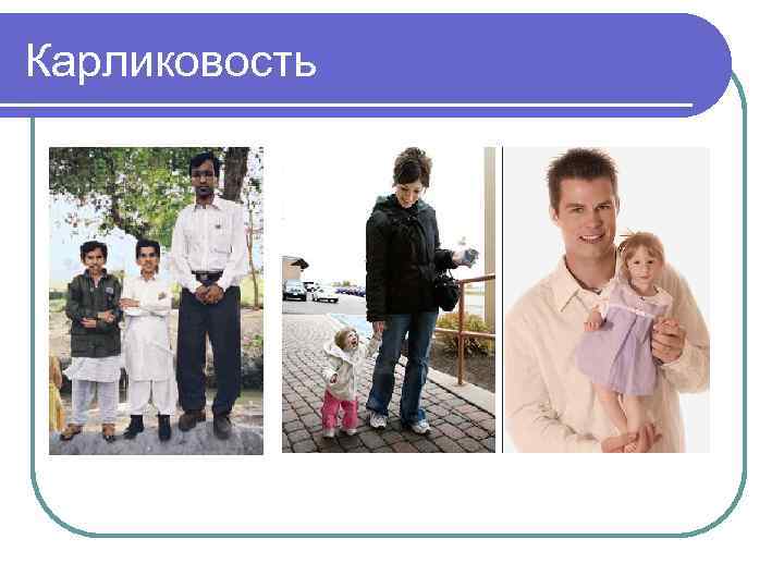 Карликовость 