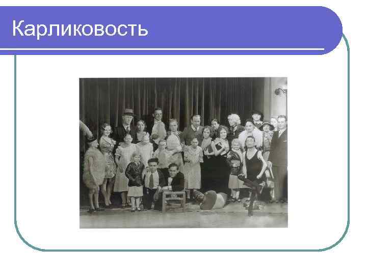 Карликовость 