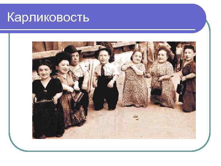 Карликовость 