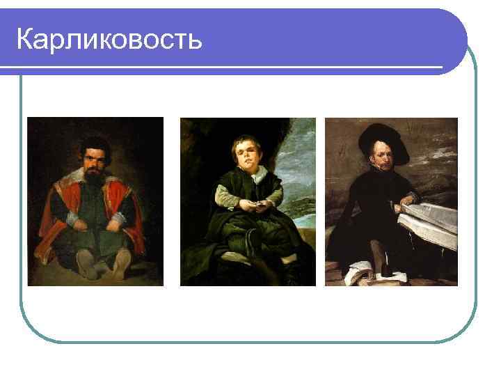 Карликовость 