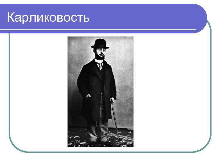 Карликовость 