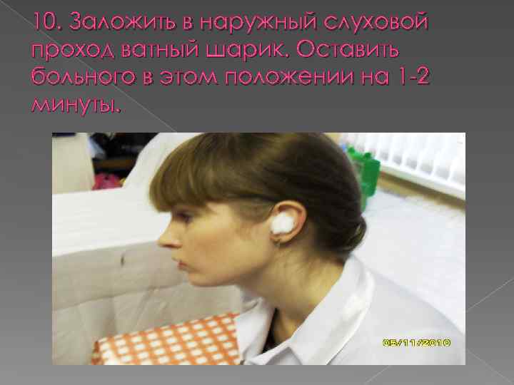 10. Заложить в наружный слуховой проход ватный шарик. Оставить больного в этом положении на