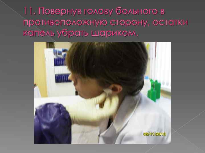 11. Повернув голову больного в противоположную сторону, остатки капель убрать шариком. 