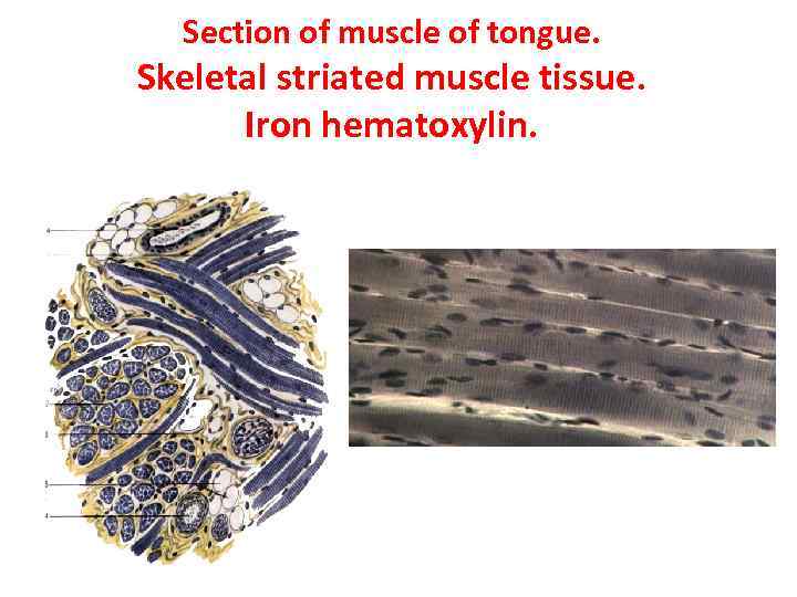 Section of muscle of tongue. Skeletal striated muscle tissue. Iron hematoxylin. 