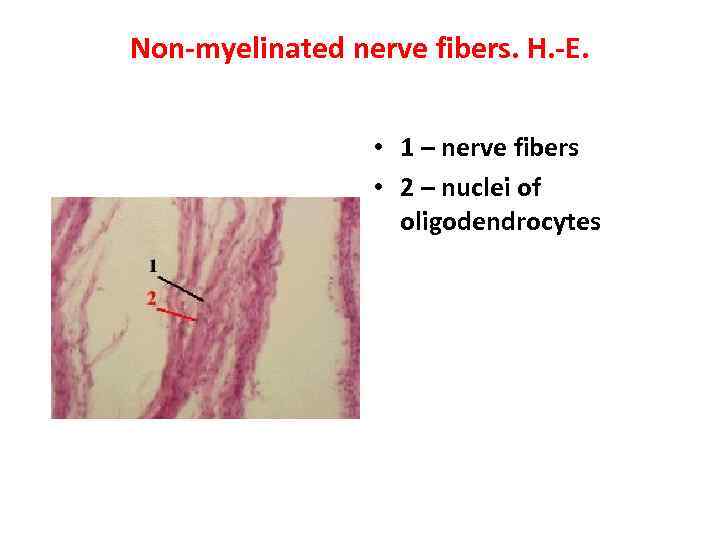 Non-myelinated nerve fibers. H. -E. • 1 – nerve fibers • 2 – nuclei